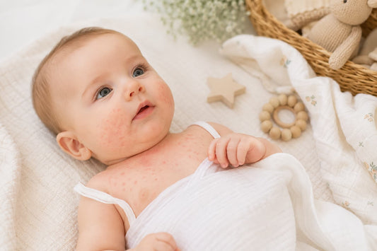 Descubre qué es la sudamina en bebés, cómo reconocer los granitos por calor, qué puedes hacer para prevenirla y cuándo consultar al pediatra.